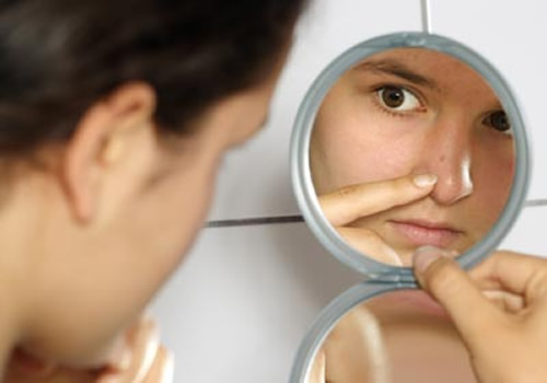 Tips Dan Cara Untuk Flek Hitam dan Jerawat Di Wajah Anda